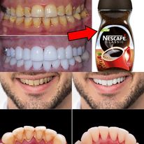 Brighten Your Smile Naturally: Teeth Whitening with Instant Coffee