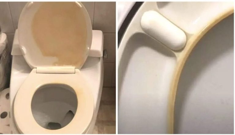 Causes of yellow stains on the toilet seat and in the toilet itself