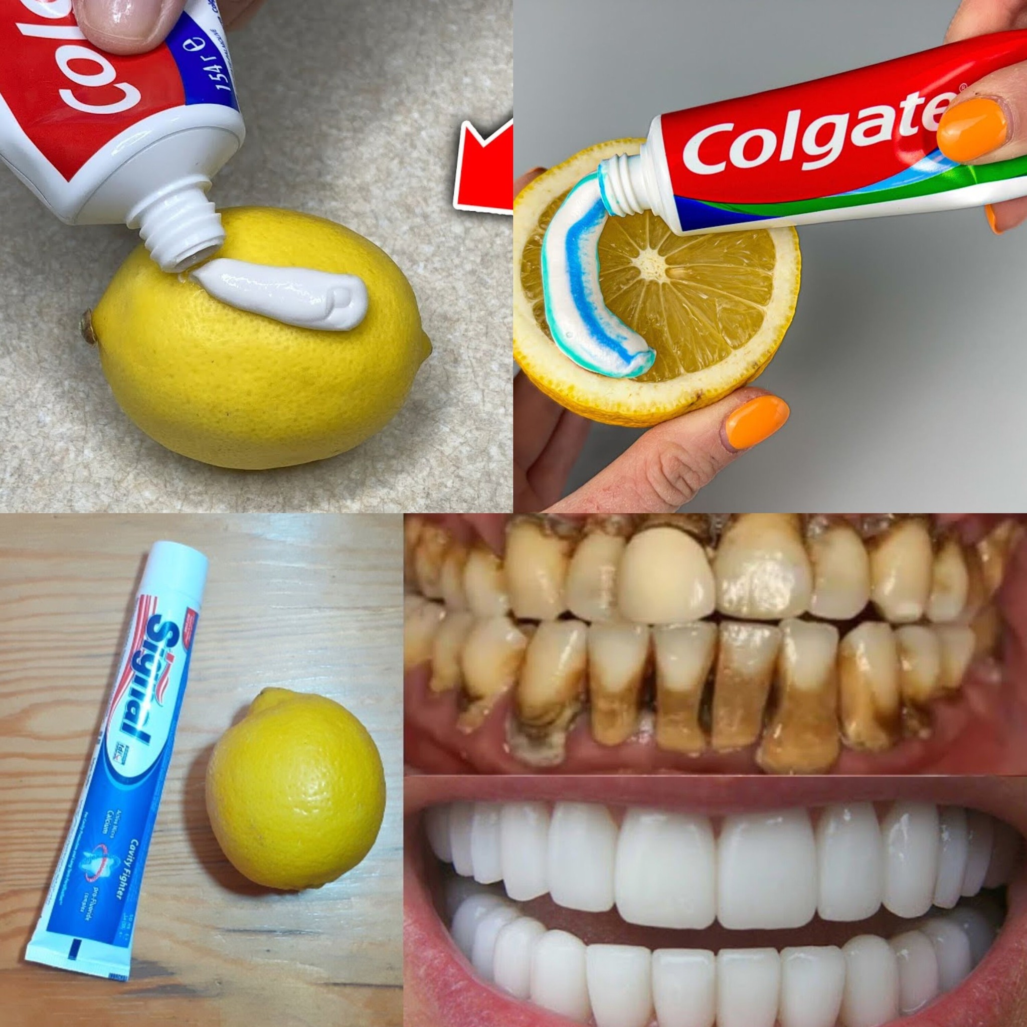 Natural mixture for yellow teeth whitening at home 