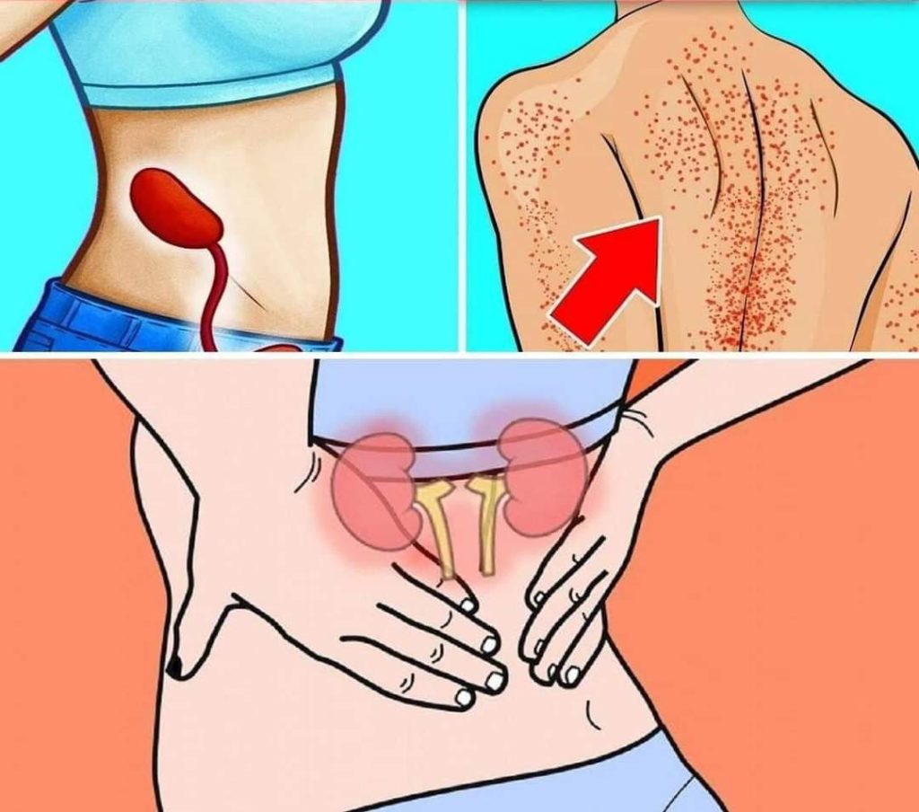 10 SIGNS YOUR KIDNEYS ARE NOT WORKING PROPERLY (1/4)!!