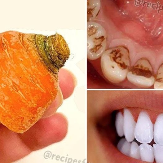 Why Carrot Tops Work for Teeth Whitening