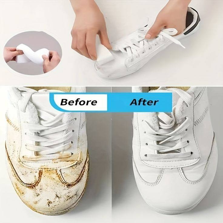 Very white shoes, nothing but bleach: this is how all the stains are removed | Now everyone does it