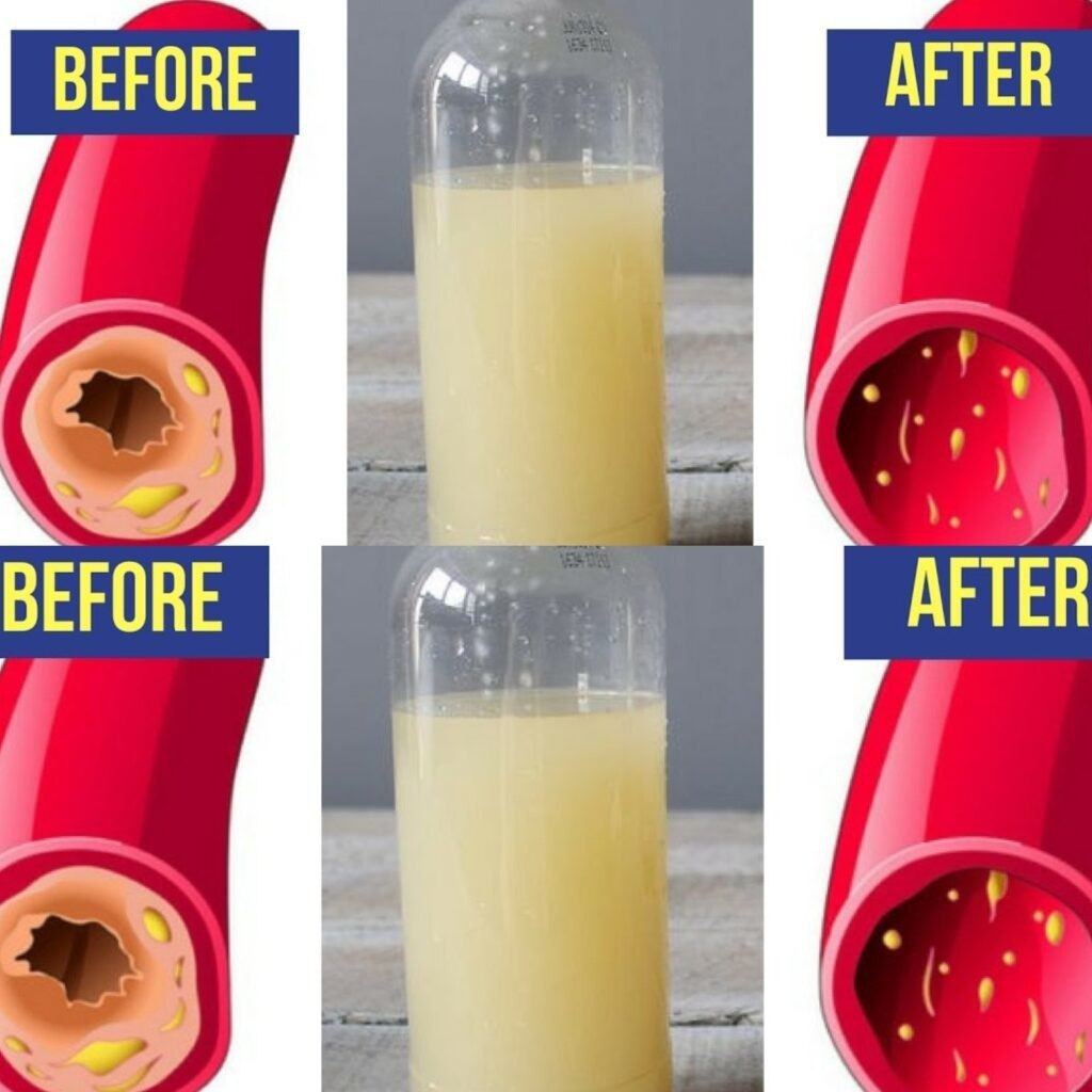 A Glass of This Juice Everyday Will Remove Clogged Arteries and Control Blood Pressure – Garlic, Lemon, and Apple Cider Vinegar