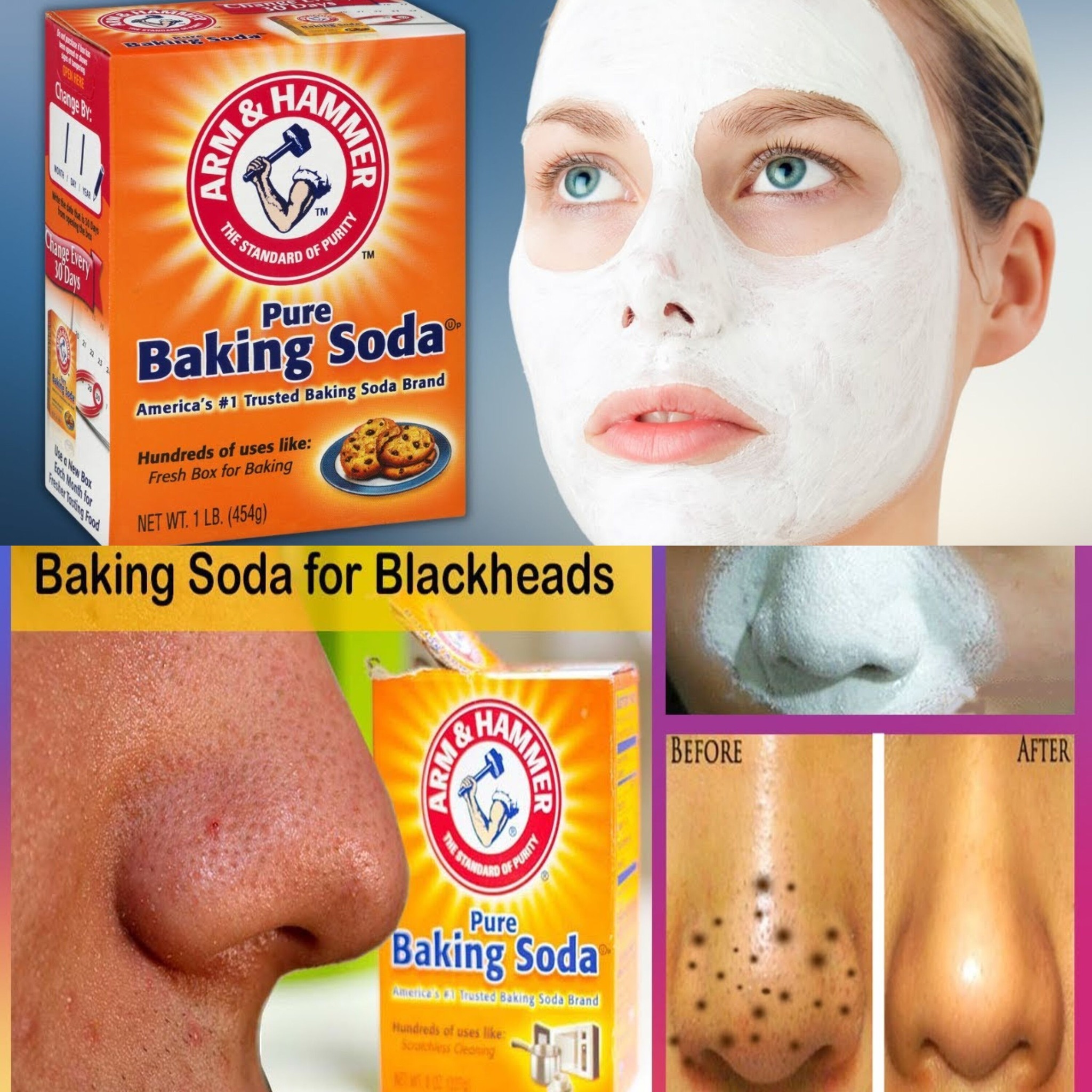 How To Remove Blackheads With Baking Soda