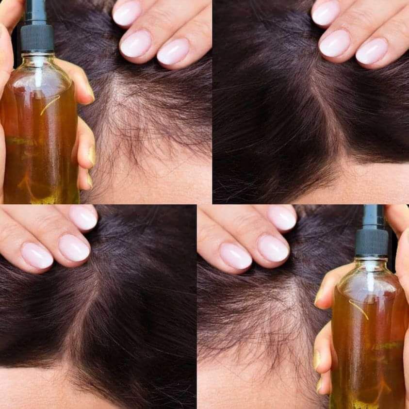 Homemade Remedy for Luxurious Locks