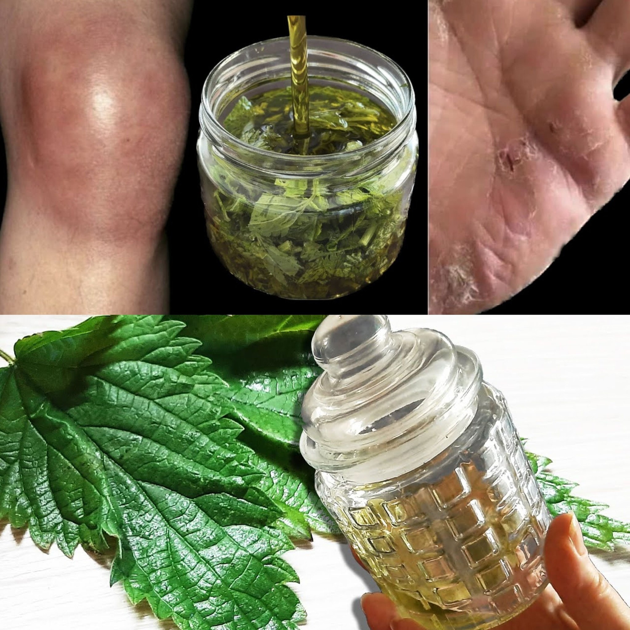 This oil erases eczema from your skin