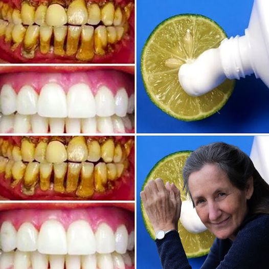 Brighten Your Smile Naturally in Just Two Minutes