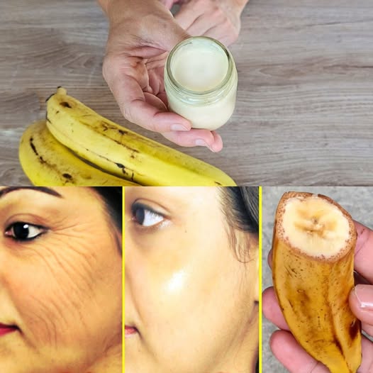 Banana Lightening Anti-Stain Cream