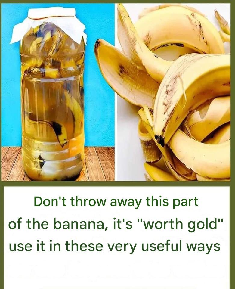 12 Things to Do with Banana Peel Instead of Throwing Them Away!