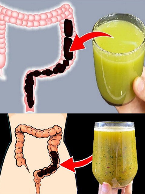 Lose weight by cleansing your colon? in 7 days