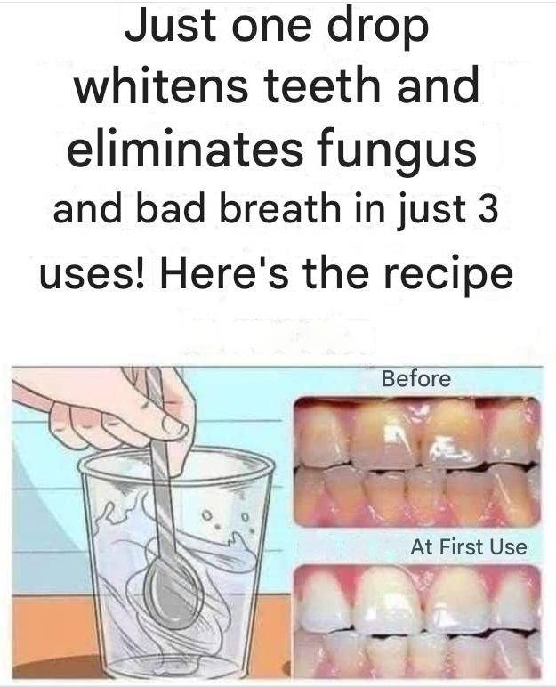 Remove tartar from your teeth and whiten them with this simple recipe.