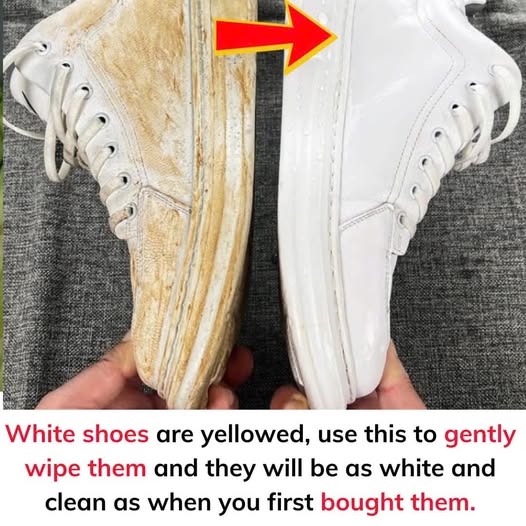 White shoes are yellowed