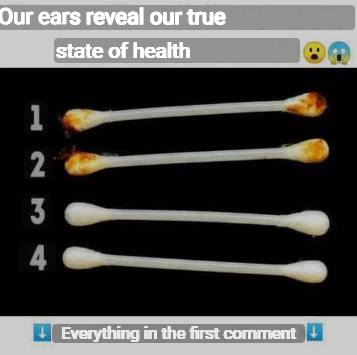 Our ears reveal our true state of health