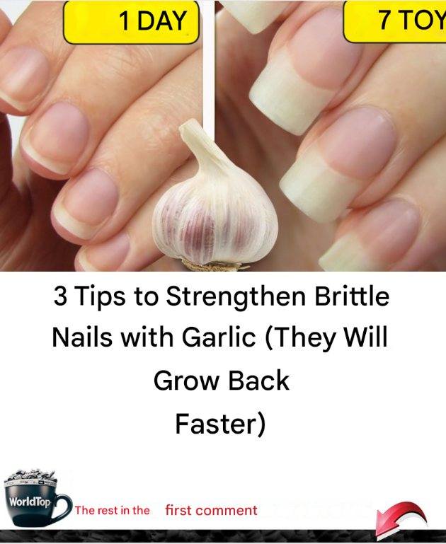 3 Tips to Strengthen Brittle Nails with Garlic (They Will Grow Back Faster)