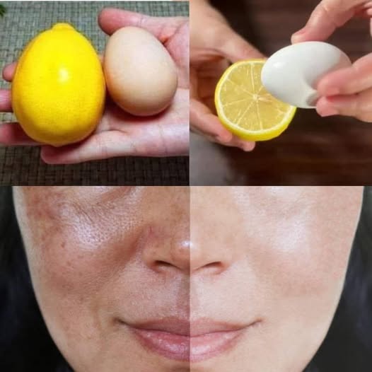 Unleashing Radiance and Youthfulness: The Amazing Combination of Lemon and Egg