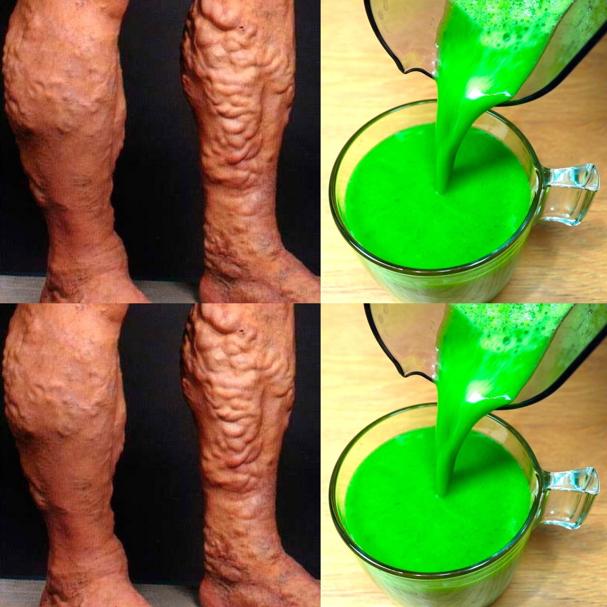 One Cup to Soothe Varicose Veins—No More Heavy Legs!