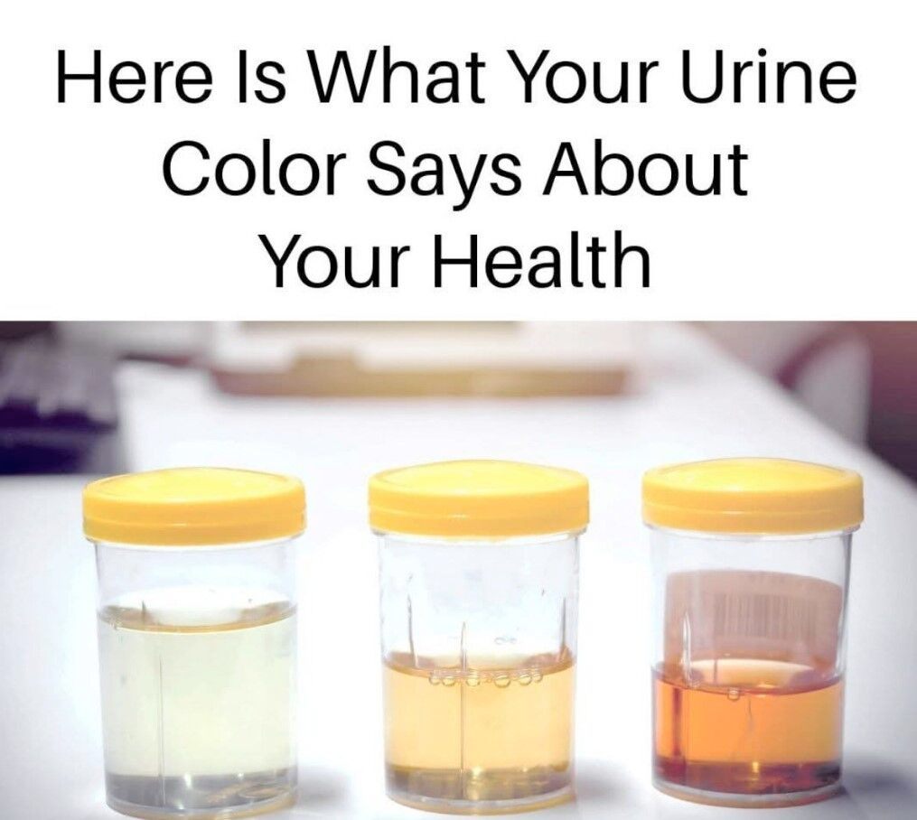 What Your Urine Color Says About Your Health