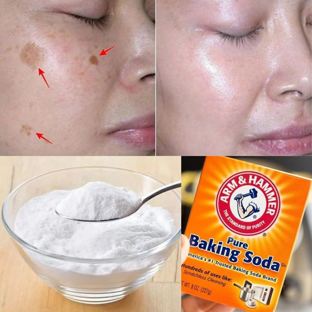 4 Ways to Erase Age Spots with Baking Soda for Youthful, Even Skin