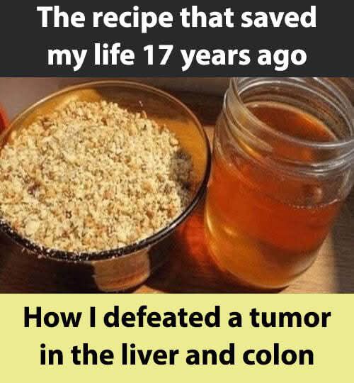 The Recipe That Saved My Life: Defeating Liver and Colon Tumors