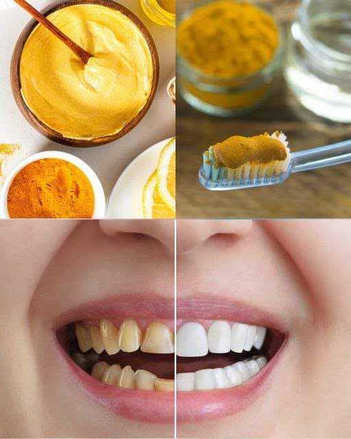 Discover the natural wonders turmeric can do for your dental health.