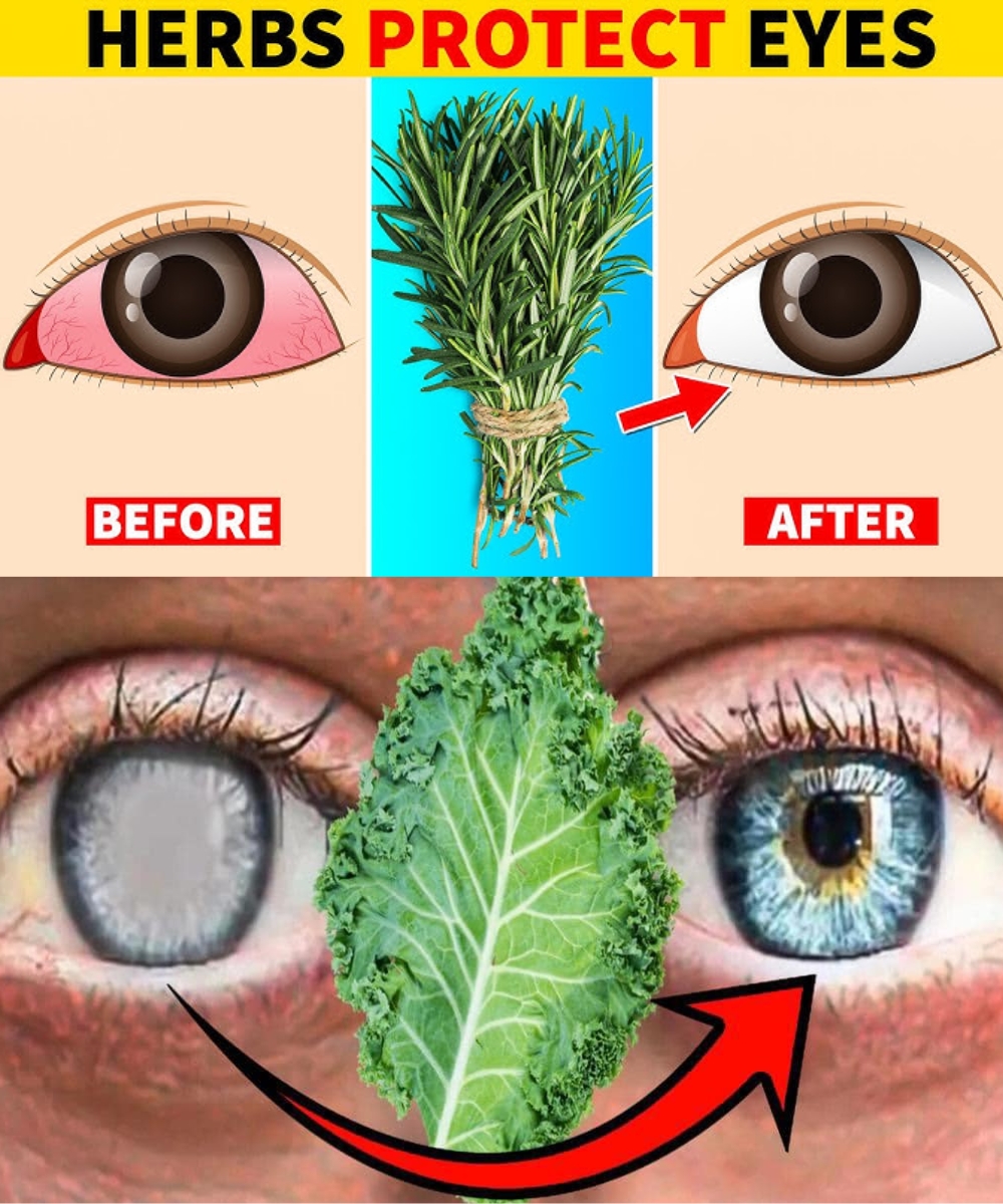 5 Essential Leaves to Naturally Improve Your Eye Health… See more 