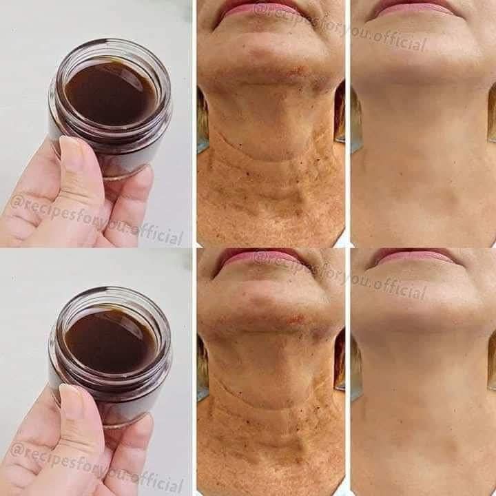 A Miracle Oil for Anti-Aging: Coffee Oil That Reduces Wrinkles More Effectively Than Botox!